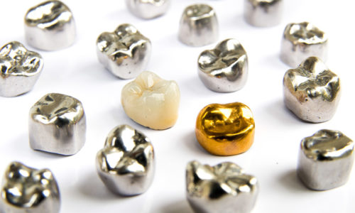 Dental ceramic, gold and metal tooth crowns on white background. Isolated.