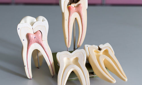 Tooth model for education in laboratory.